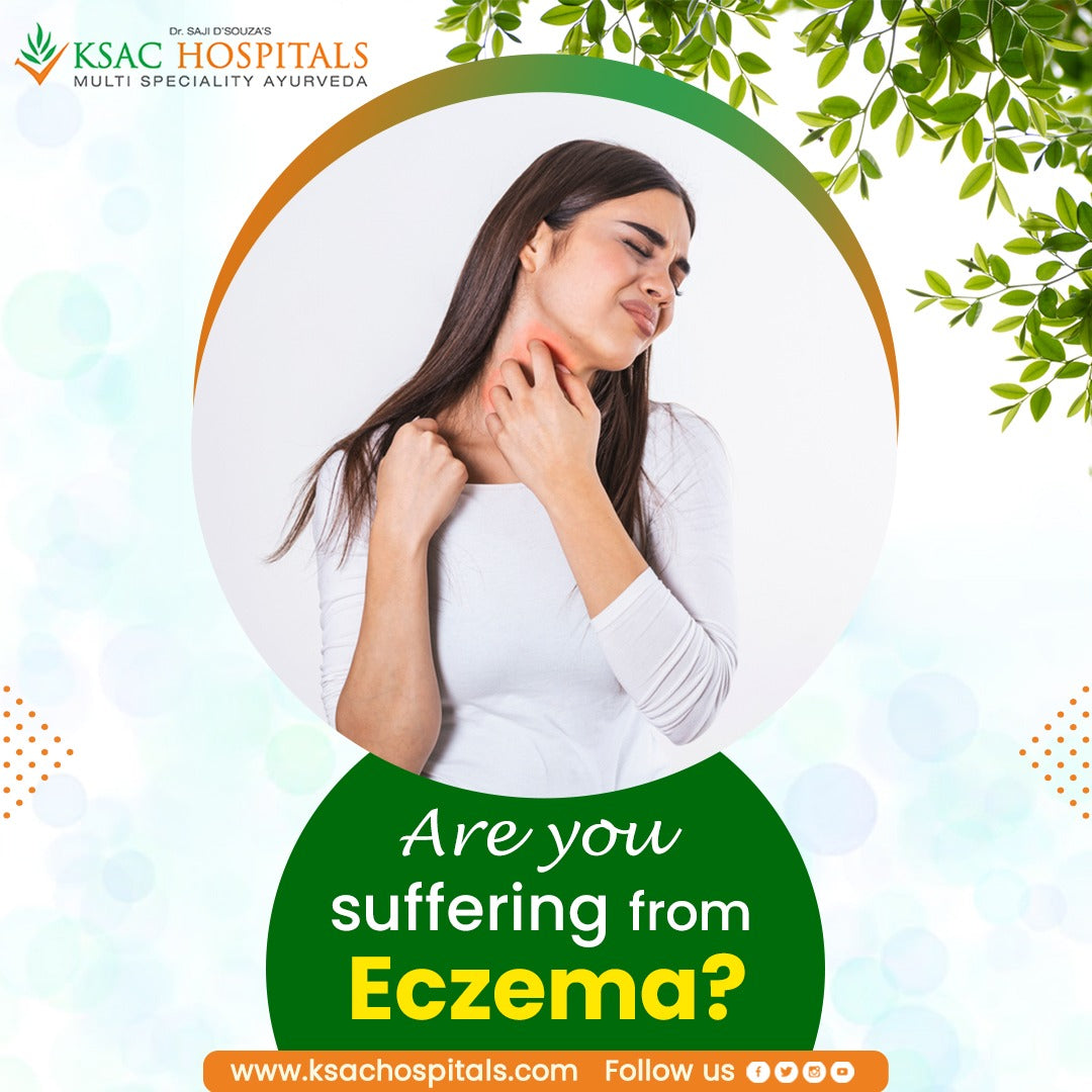 Best Ayurvedic Treatment For Eczema