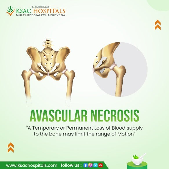 Avascular Necrosis