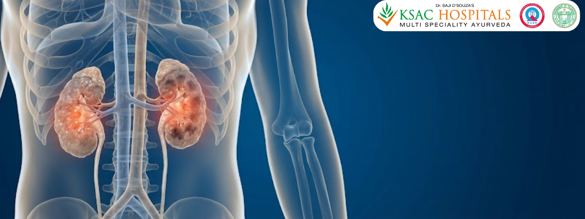 Kidney Disease Ayurvedic Treatment | KSAC Hyderabad