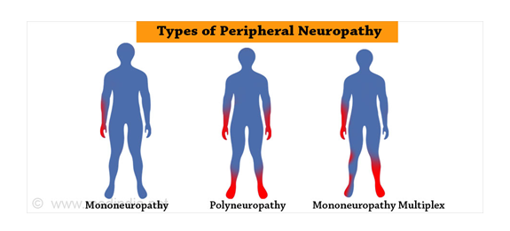 An overview of best ayurvedic hospital for neuropathy in Hyderabad