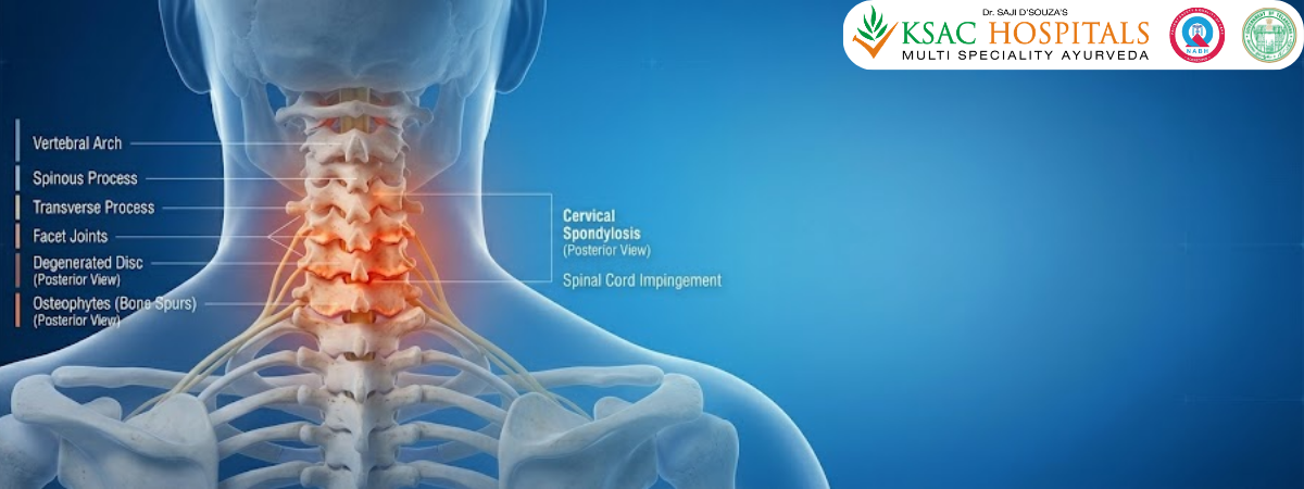 Tech Neck to Cervical Spondylosis How Chronic Neck Conditions Are Treated Without Painkillers