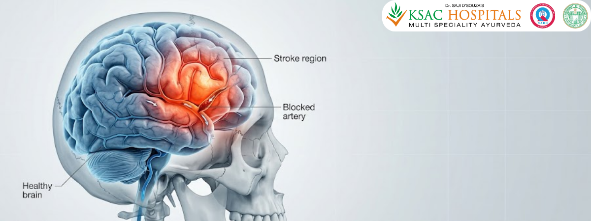 Post-Stroke Neuro-Rehabilitation: Restoring Sensory and Motor Function Through Traditional Medicine