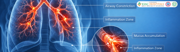 Asthma Treatment in Ayurveda: A Clinical Perspective on Respiratory Recovery