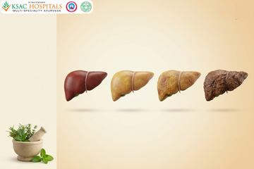 Fatty Liver Grade 2 Ayurvedic Treatment: Grade 1 vs Grade 2