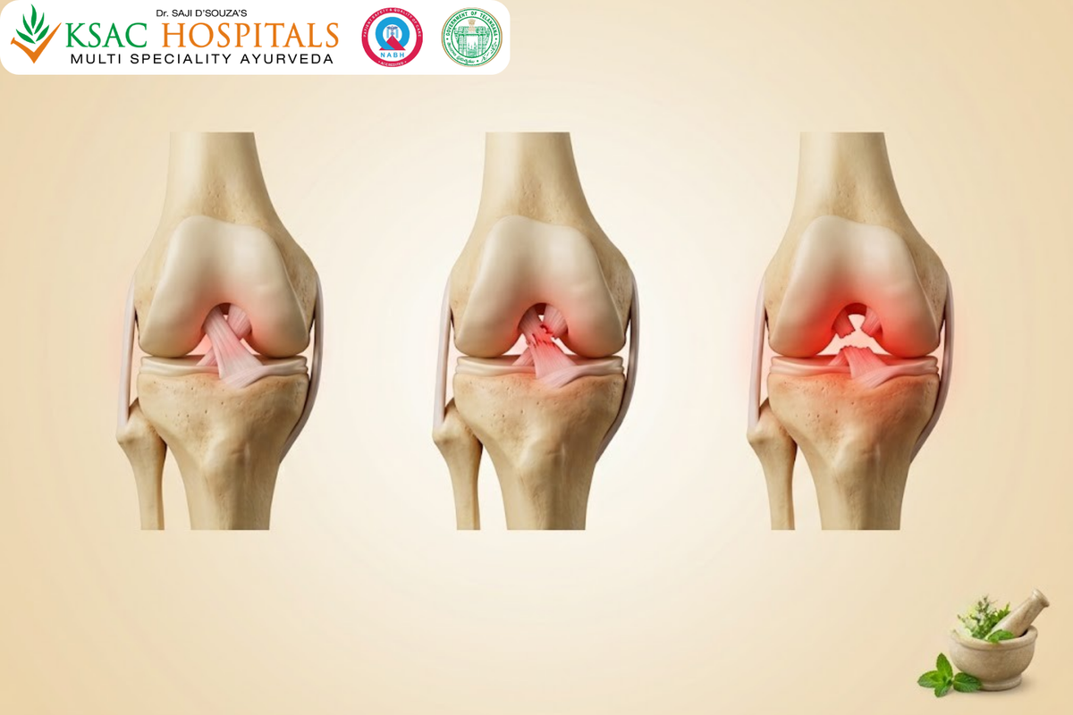 Ligament Tear in Knee Ayurvedic Treatment: Non-Surgical Care for ACL and MCL Injuries