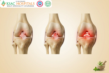 Ligament Tear in Knee Ayurvedic Treatment: Non-Surgical Care for ACL and MCL Injuries