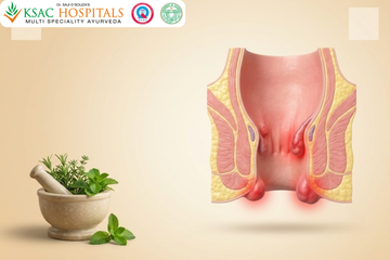Piles Treatment in Ayurveda: Para-Surgical Care for Hemorrhoids Without Conventional Surgery