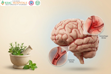 Ayurvedic Treatment for Stroke: Managing the Risk Factors That Cause It