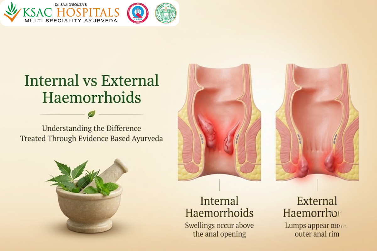 Difference Between Internal and External Haemorrhoids
