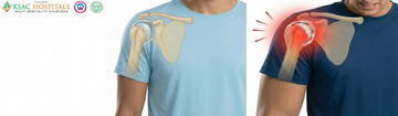 comparing an inflamed shoulder joint capsule with a healthy capsule